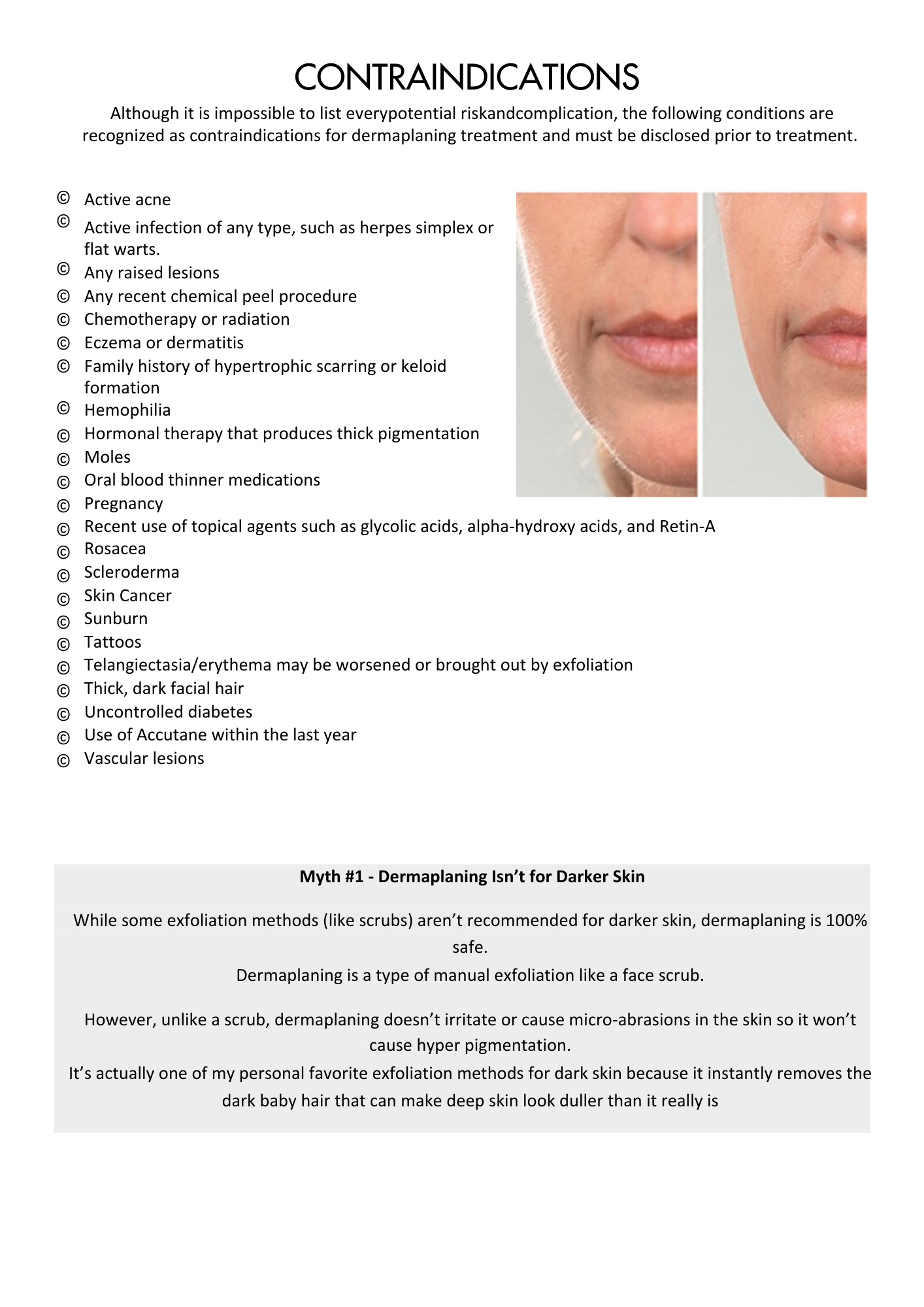 Dermaplaning Training Manual: Professional Step-by-Step Guide for Estheticians (Digital Download)